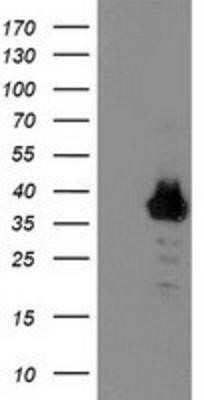 Western Blot: ZNF397 Antibody (OTI1F3)Azide and BSA Free [NBP2-74950]