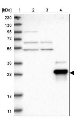 Western Blot: ZNF397 Antibody [NBP1-82753]