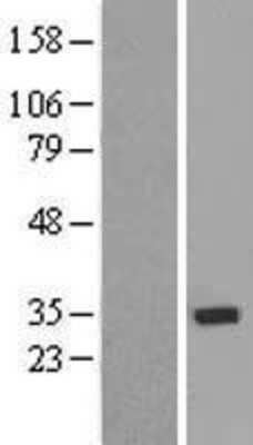 Western Blot: ZNF397 Overexpression Lysate [NBL1-18141]