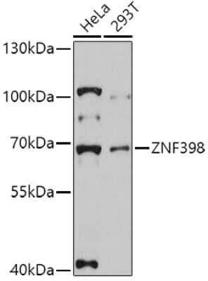 Western Blot: ZNF398 AntibodyAzide and BSA Free [NBP2-94651]