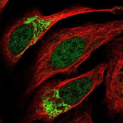 Immunocytochemistry/ Immunofluorescence: ZNF398 Antibody [NBP2-57260]