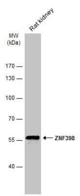 Western Blot: ZNF398 Antibody [NBP1-31317]