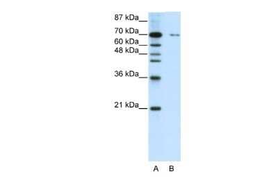 Western Blot: ZNF398 Antibody [NBP2-88682]