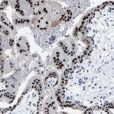 Immunohistochemistry-Paraffin: ZNF406 Antibody [NBP2-13542]