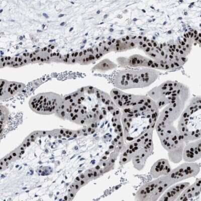 Immunohistochemistry-Paraffin: ZNF406 Antibody [NBP2-13542]