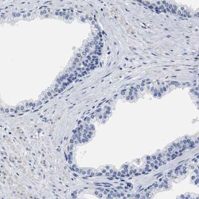 Immunohistochemistry-Paraffin: ZNF406 Antibody [NBP2-13542]