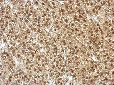 Immunohistochemistry-Paraffin: ZNF406 Antibody [NBP2-21005]