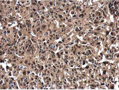 Immunohistochemistry-Paraffin: ZNF406 Antibody [NBP2-21005]