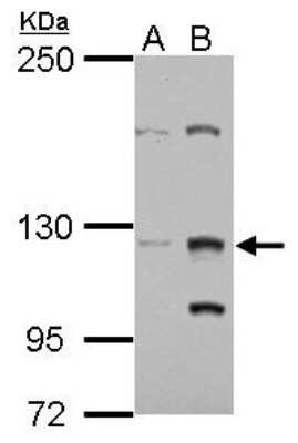 Western Blot: ZNF406 Antibody [NBP2-21005]