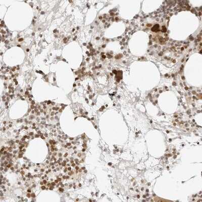 Immunohistochemistry-Paraffin: ZNF407 Antibody [NBP1-82248]