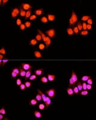 Immunocytochemistry/ Immunofluorescence: ZNF408 Antibody - BSA Free [NBP2-94588]