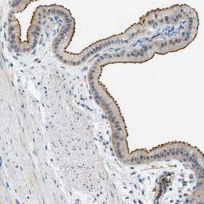 Immunohistochemistry-Paraffin: ZNF408 Antibody [NBP1-82280]