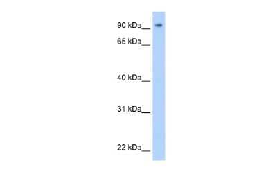 Western Blot: ZNF408 Antibody [NBP2-88686]