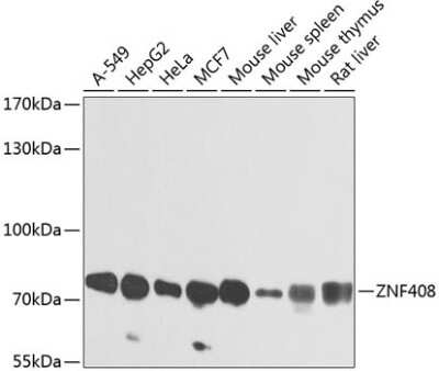 Western Blot: ZNF408 AntibodyBSA Free [NBP2-94727]