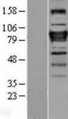 Western Blot: ZNF408 Overexpression Lysate [NBL1-18143]