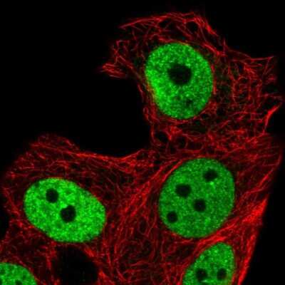 Immunocytochemistry/ Immunofluorescence: ZNF41 Antibody [NBP2-49585]