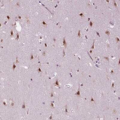 Immunohistochemistry-Paraffin: ZNF41 Antibody [NBP2-49585]
