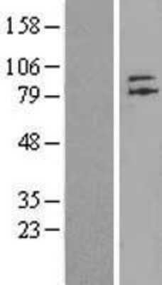 Western Blot: ZNF41 Overexpression Lysate [NBL1-18144]