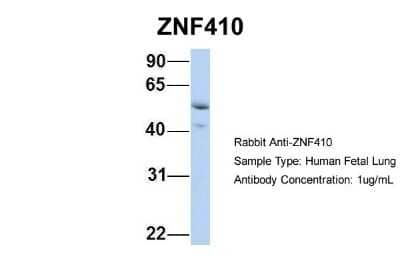 Western Blot: ZNF410 Antibody [NBP2-86918]