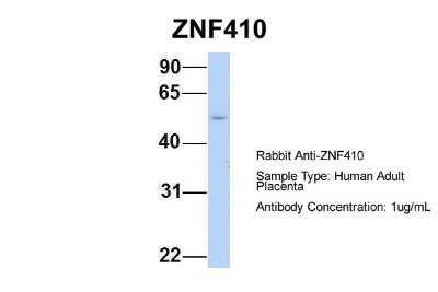 Western Blot: ZNF410 Antibody [NBP2-86918]
