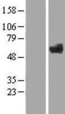 Western Blot: ZNF410 Overexpression Lysate [NBP2-06546]