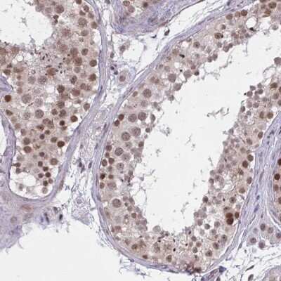 Immunohistochemistry: ZNF414 Antibody [NBP2-33693]