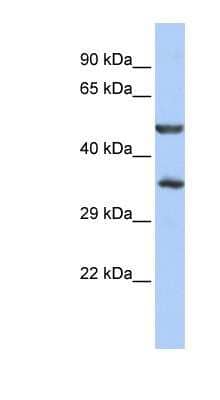 Western Blot: ZNF414 Antibody [NBP1-80378]