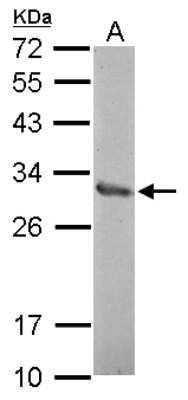 Western Blot: ZNF414 Antibody [NBP2-21009]