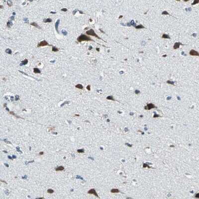 Immunohistochemistry-Paraffin: ZNF415 Antibody [NBP1-89466]