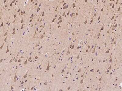 Immunohistochemistry-Paraffin: ZNF415 Antibody [NBP2-98201]