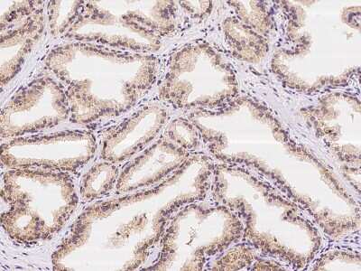 Immunohistochemistry-Paraffin: ZNF415 Antibody [NBP2-98201]