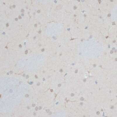 Immunohistochemistry-Paraffin: ZNF415 Antibody - BSA Free [NBP3-04366]