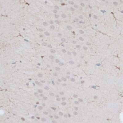 Immunohistochemistry-Paraffin: ZNF415 Antibody - BSA Free [NBP3-04366]