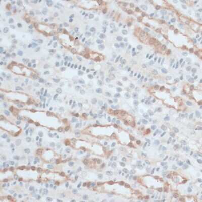 Immunohistochemistry-Paraffin: ZNF415 Antibody - BSA Free [NBP3-04366]