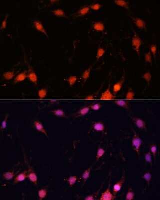 Immunocytochemistry/ Immunofluorescence: ZNF416 Antibody - Azide and BSA Free [NBP3-05072]