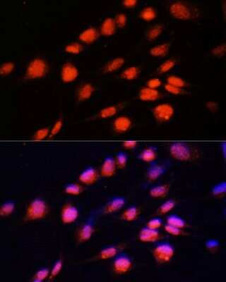 Immunocytochemistry/ Immunofluorescence: ZNF416 Antibody - Azide and BSA Free [NBP3-05072]