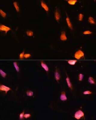 Immunocytochemistry/ Immunofluorescence: ZNF416 Antibody - Azide and BSA Free [NBP3-05072]