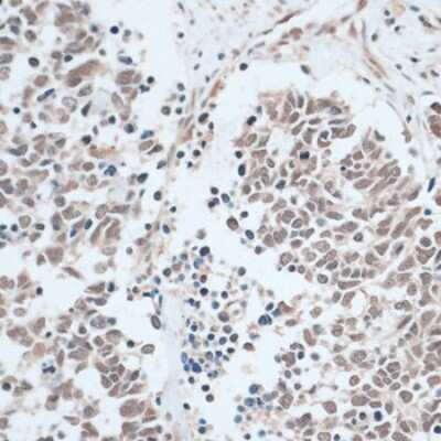 Immunohistochemistry-Paraffin: ZNF416 Antibody - Azide and BSA Free [NBP3-05072]