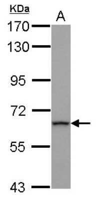 Western Blot: ZNF416 Antibody [NBP2-15174]