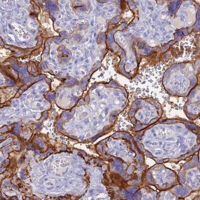 Immunohistochemistry: ZNF418 Antibody [NBP2-33403]