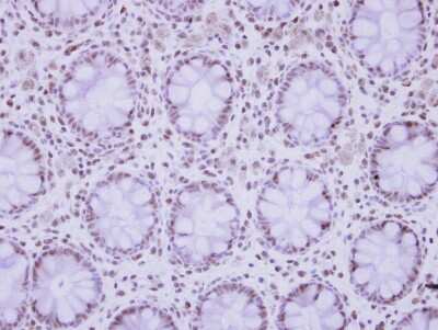 Immunohistochemistry-Paraffin: ZNF418 Antibody [NBP2-21012]