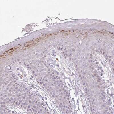 Immunohistochemistry-Paraffin: ZNF814 Antibody [NBP2-46814]