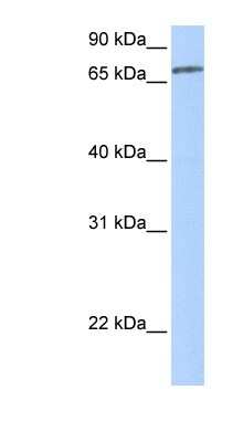 Western Blot: ZNF418 Antibody [NBP1-79412]