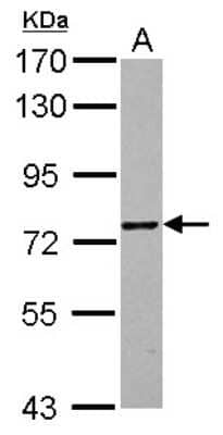 Western Blot: ZNF418 Antibody [NBP2-21012]