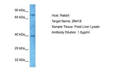 Western Blot: ZNF418 Antibody [NBP2-88690]