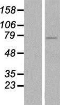 Western Blot: ZNF418 Overexpression Lysate [NBP2-05701]