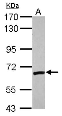 Western Blot: ZNF419A Antibody [NBP2-21014]