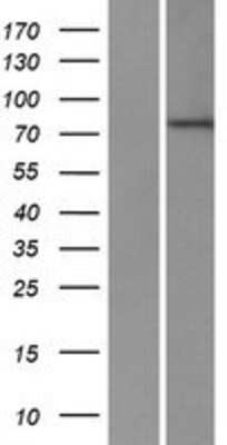 Western Blot: ZNF420 Overexpression Lysate [NBP2-05536]