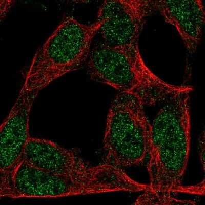 Immunocytochemistry/ Immunofluorescence: ZNF423 Antibody [NBP2-57466]