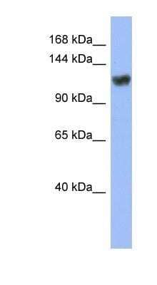 Western Blot: ZNF423 Antibody [NBP1-80329]